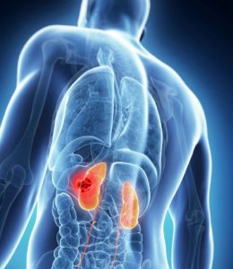 kidney-damage graphic