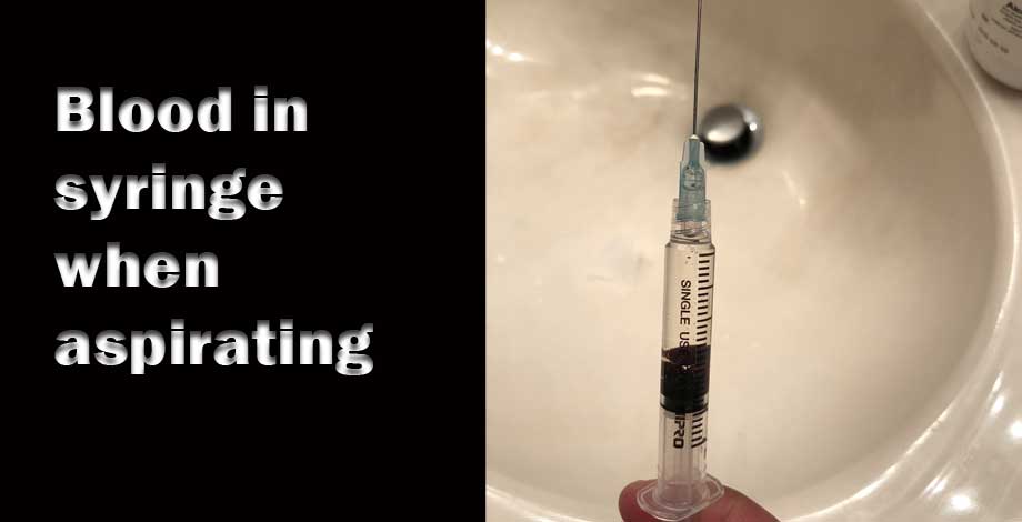 blood in syringe when aspir